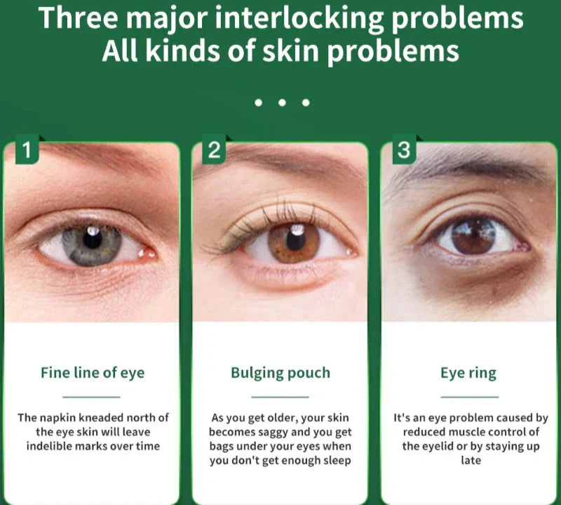 Anti-Wrinkle Photon Therapy Facial & Eye Massager Green-2